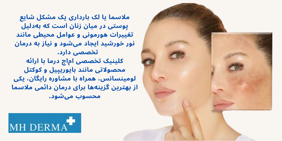 _2بهترین درمان لک صورت و لک های بارداری - MH derma ملاسما یا لک بارداری یک مشکل شایع پوستی در میان زنان است که بهدلیل تغییرات هورمونی و عوامل محیطی مانند نور خورشید ایجاد میشود و نیاز به درمان تخصصی دارد. کلینیک تخصصی اماچ درما با ارائه روشهای پیشرفته مانند بایوریپیل و کوکتل لومینسانس، همراه با مشاوره رایگان، یکی از بهترین گزینهها برای درمان دائمی ملاسما محسوب میشود.